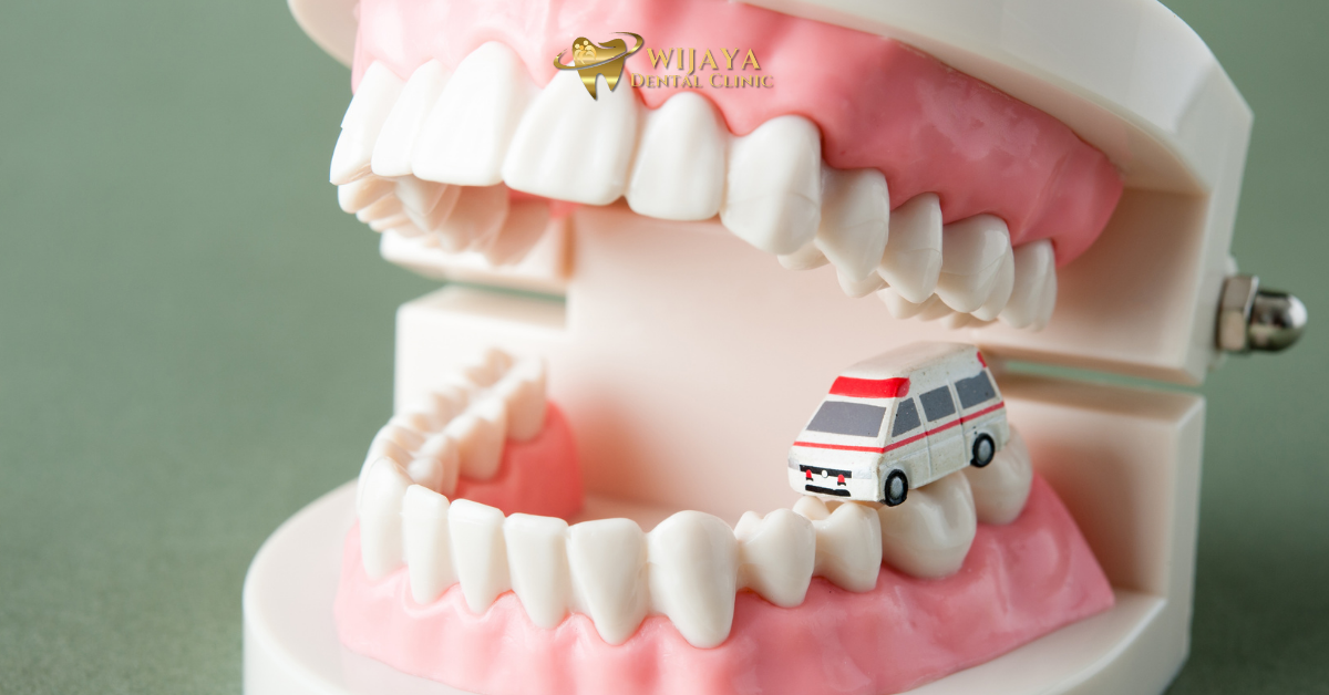 Jumlah Gigi Permanen pada Orang Dewasa dan Pentingnya Perawatan Sejak Awal