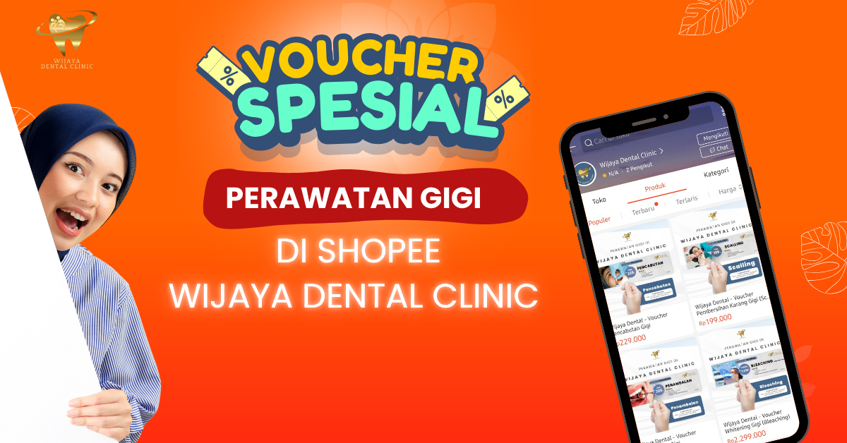 Senyum Sehat, Dompet Hemat! Wijaya Dental Clinic Kini Hadir di Shopee dengan Promo Fantastis!